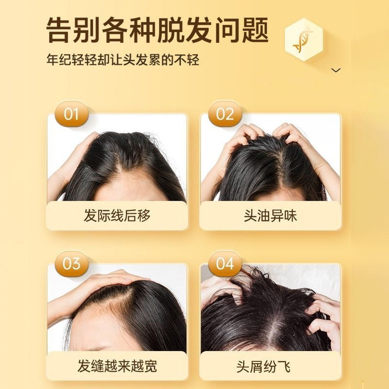 Tiktok/Douyin Hot YaoPing Anti-Hair Loss Hair Growth Shampoo 300ml 【Tiktok抖音爆款】瑶品苗坚防脱育发洗发水