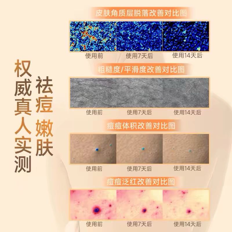CIBIO'2 AHA Body Wash 420ml 希蓓欧果酸沐浴露