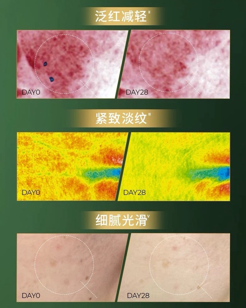 AOXMED Multi-Layer Repair Soothing Serum 30ml 瑷科缦多层修护舒颜精华露