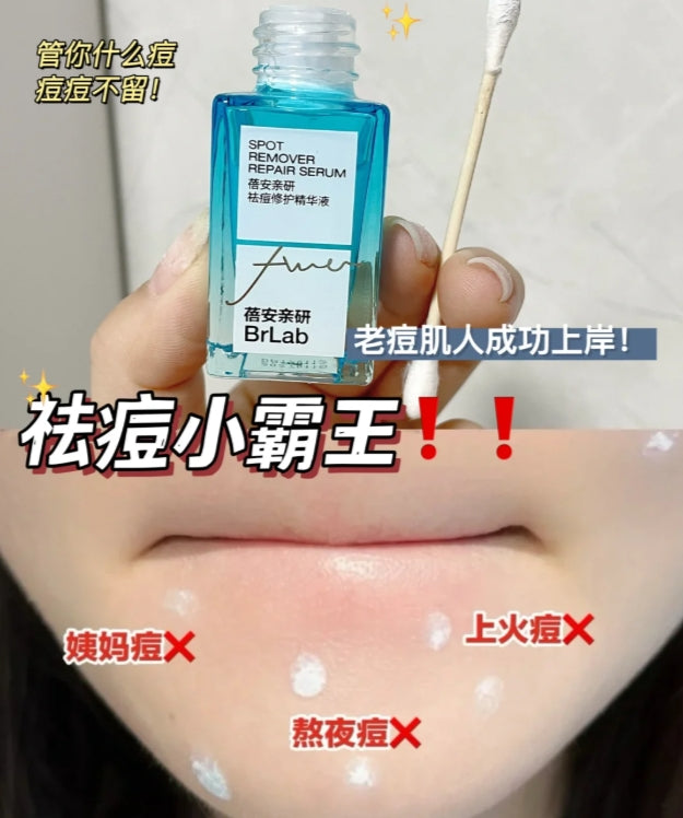 Tiktok/Douyin Hot BR:LAB Acne Repair Essence 10ml【Tiktok抖音爆款】蓓安亲研祛痘修护精华液