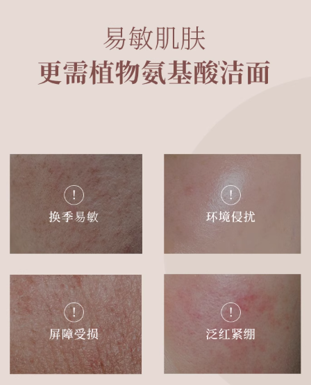 Tiktok/Douyin Hot CHUNMA Coconut Oil Amino Acid Facial Cleanser 80g【Tiktok抖音爆款】纯妈椰油氨基酸洗面奶