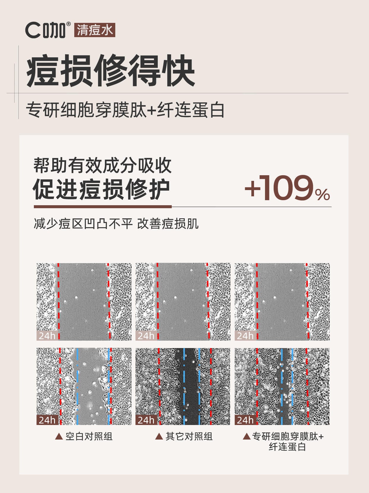 C咖 Caffeine Acne Treatment Oil-Control Repair Toner 200ml C咖净痘控油修护调理水