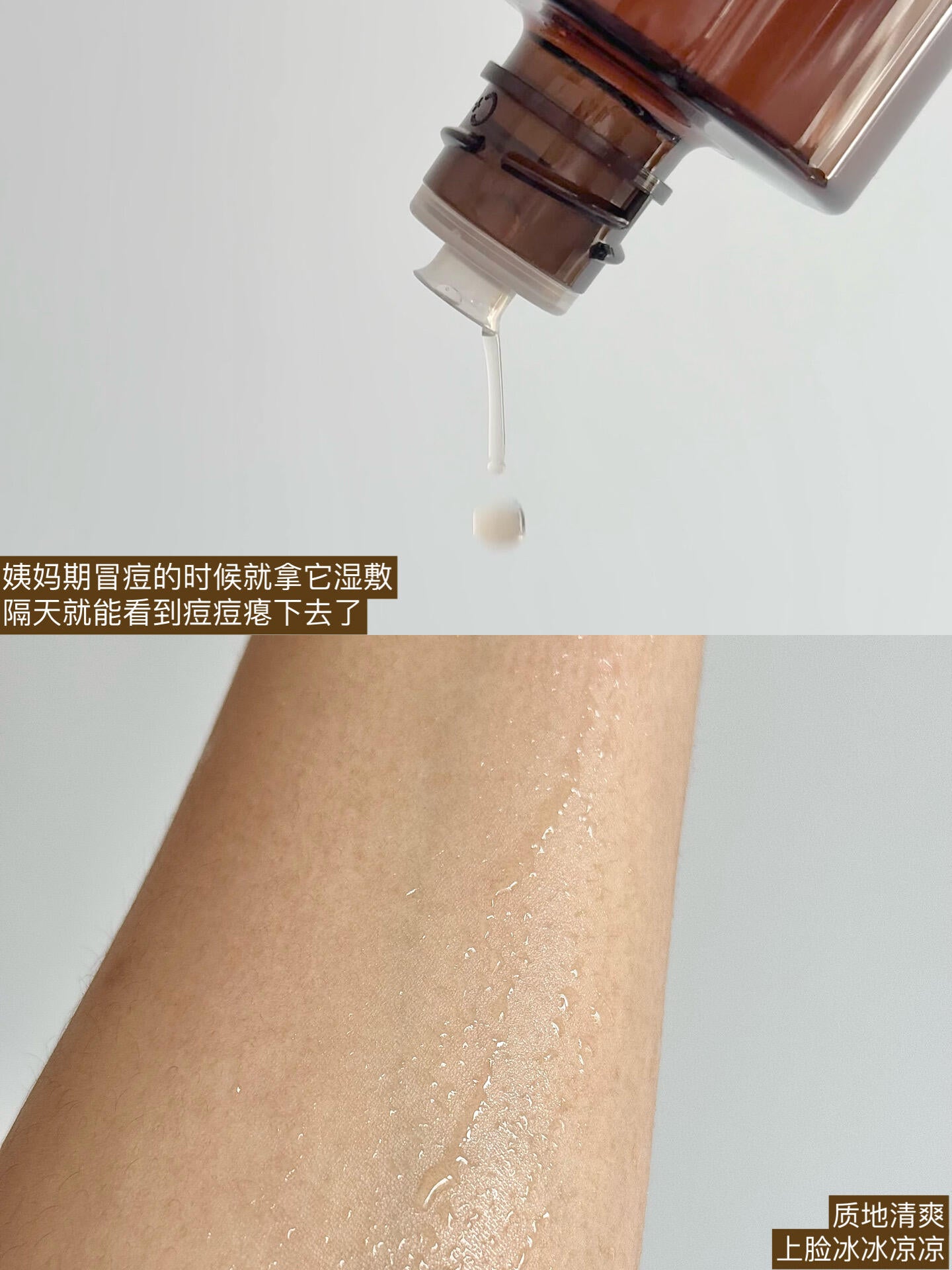 C咖 Caffeine Acne Treatment Oil-Control Repair Toner 200ml C咖净痘控油修护调理水
