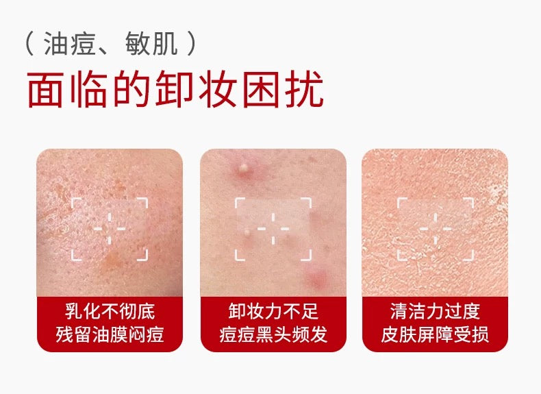 DR. WU Mandelik Gentle Anti-Acne Cleansing Balm 80g 达尔肤杏仁酸温和净痘卸妆膏