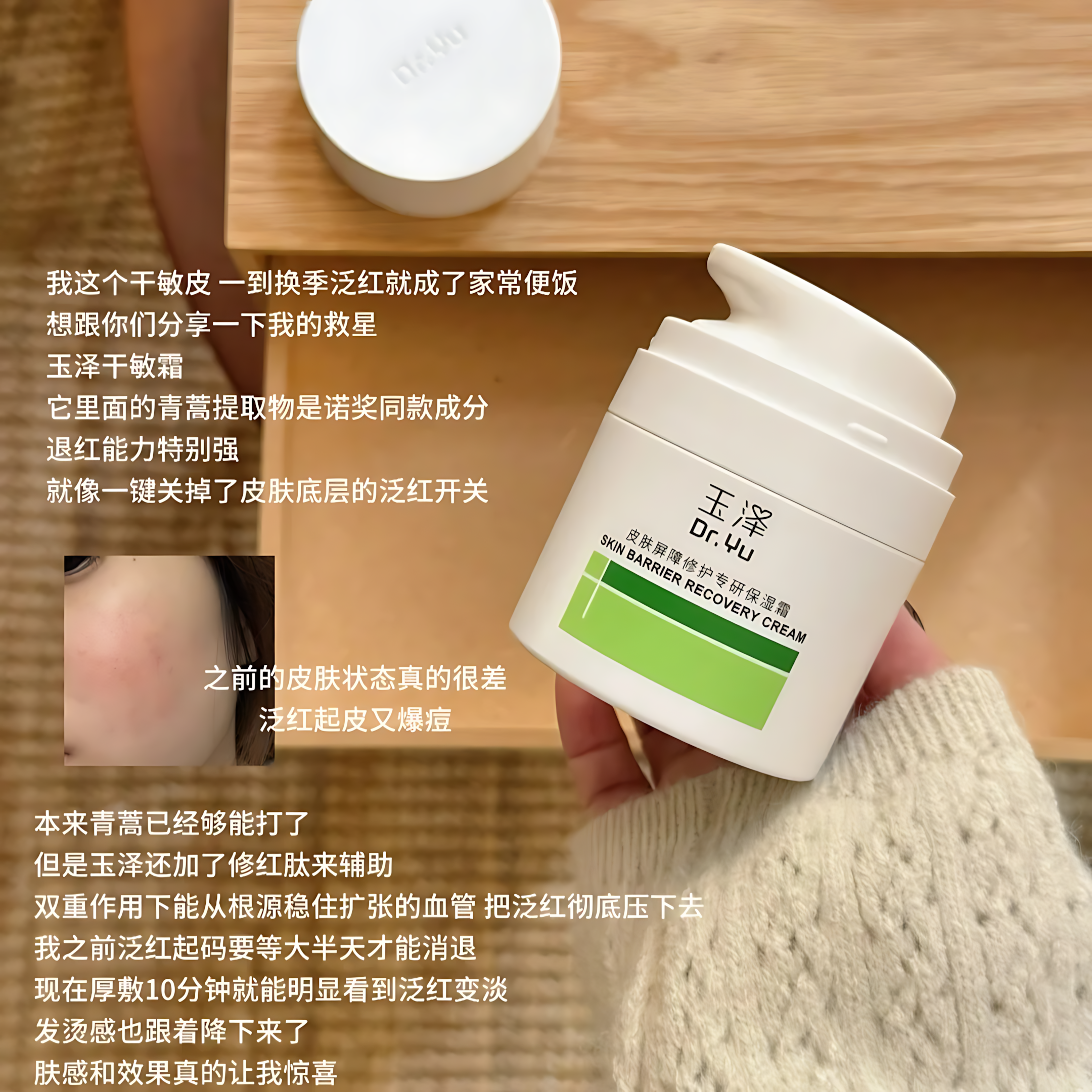 DR.YU Skin Barrier Recovery Gel Cream 2.0 50g 玉泽皮肤屏障修护专研保湿霜2.0