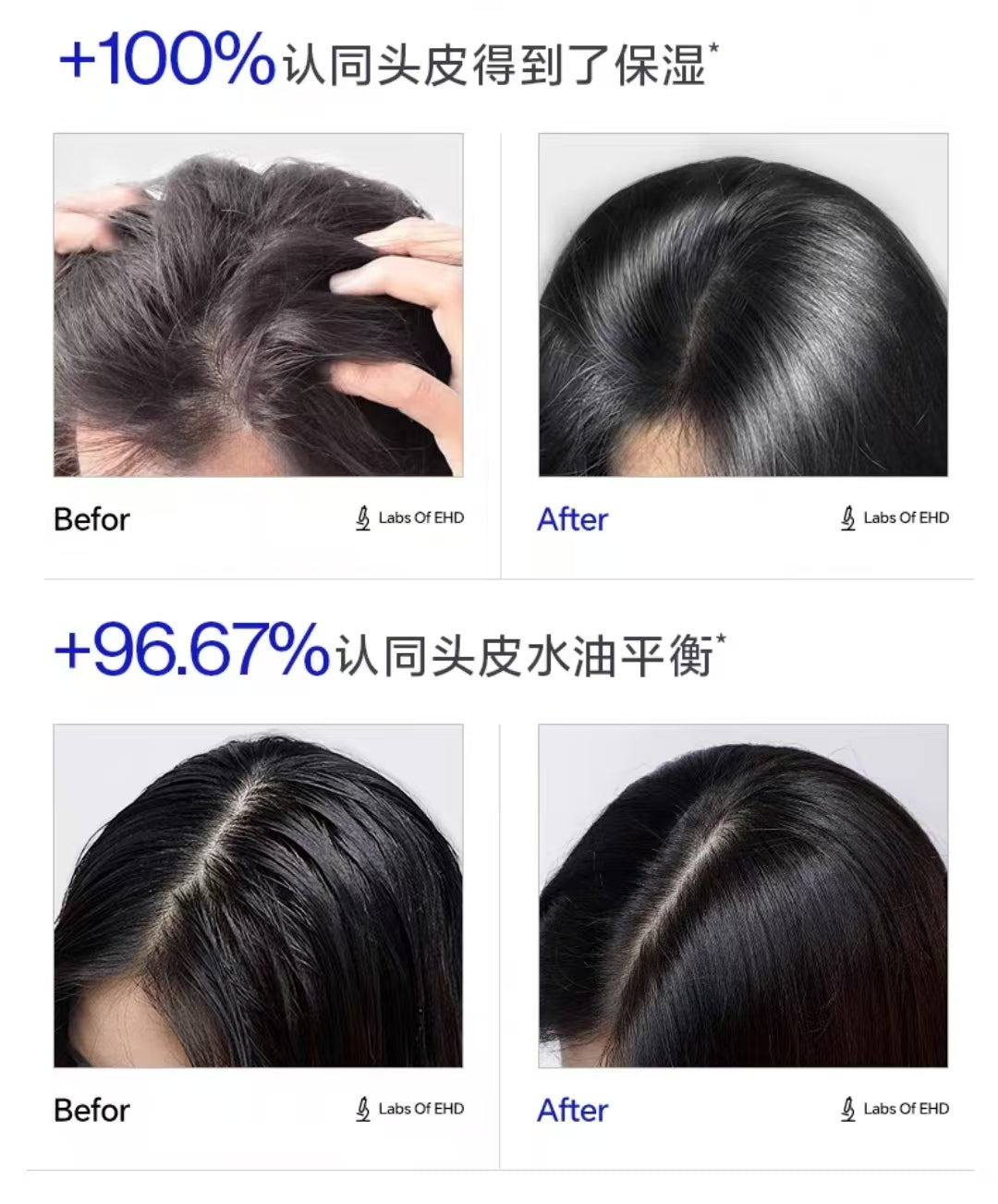 EHD Thirteen Plant Based Scalp Care Fluids 50ml*6pcs EHD十三重植萃头皮养护液