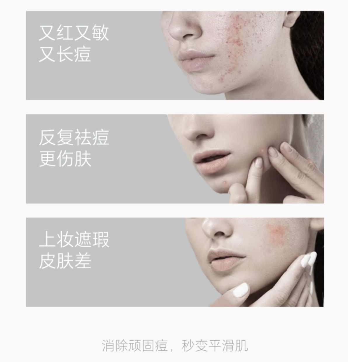 ELL Eucalyptus Leaf & Salicylic Acid Oil Control & Acne Clear Toner & Lotion 150ml+120g ELL蓝桉叶水杨酸控油清痘水乳