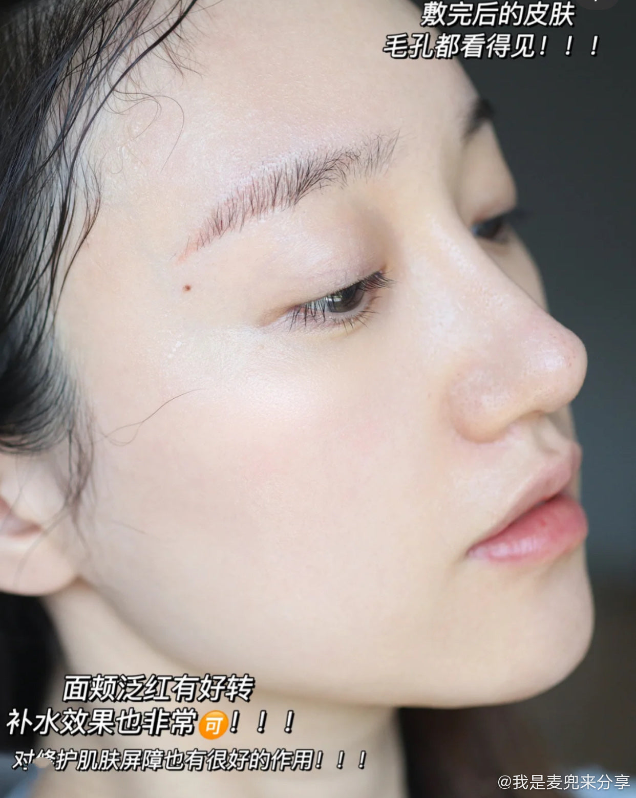Face Live Acne Repair Mask 5Pcs/Box 斐思妮修护祛痘面膜