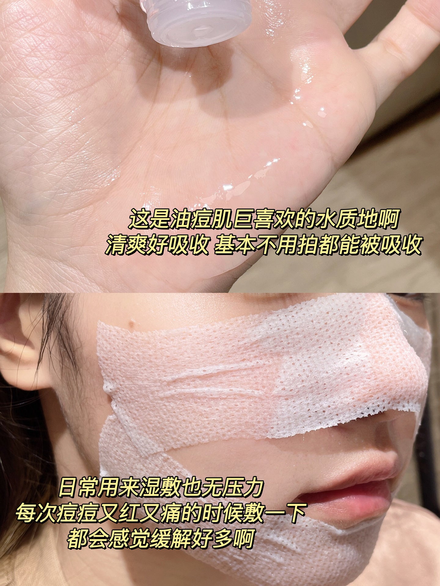 FulQun Anti-acne Oil-Control Soothing Essence Toner Lotion 150ml 芙清舒缓祛痘水&乳