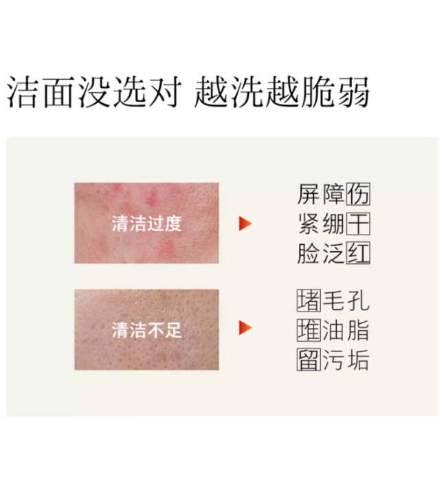 HFP Amino Acid Balance Purifying Cleanser 120g HFP氨基酸平衡净润洁面乳