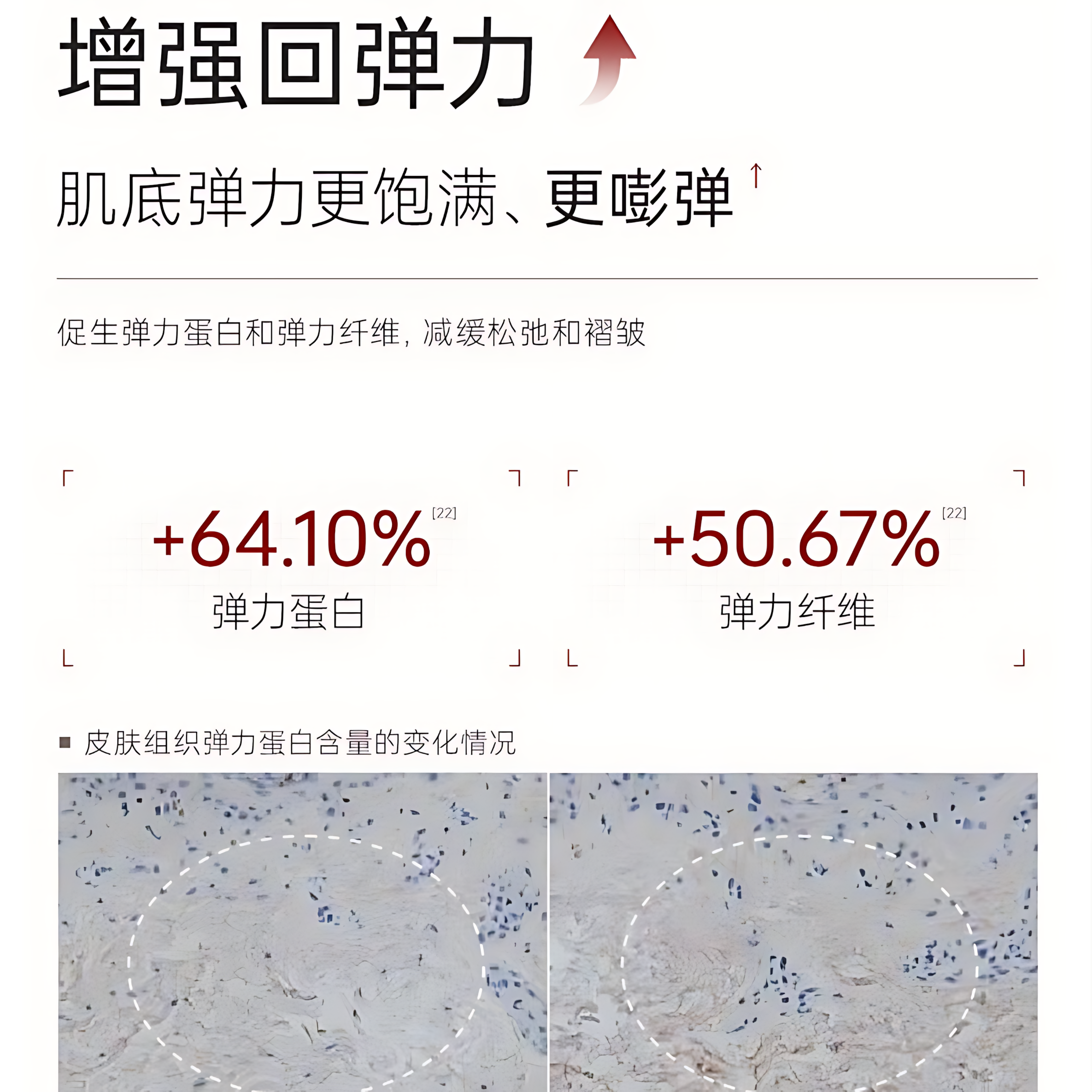 JOYRUQO Bifida Yeast Firming Light Line Essence 2.0 1.5ml*30pcs/box 娇润泉二裂酵母抗皱紧致淡纹次抛精华液2.0
