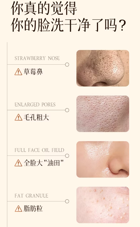 KONKA Blackhead Remover Device 康佳吸黑头仪