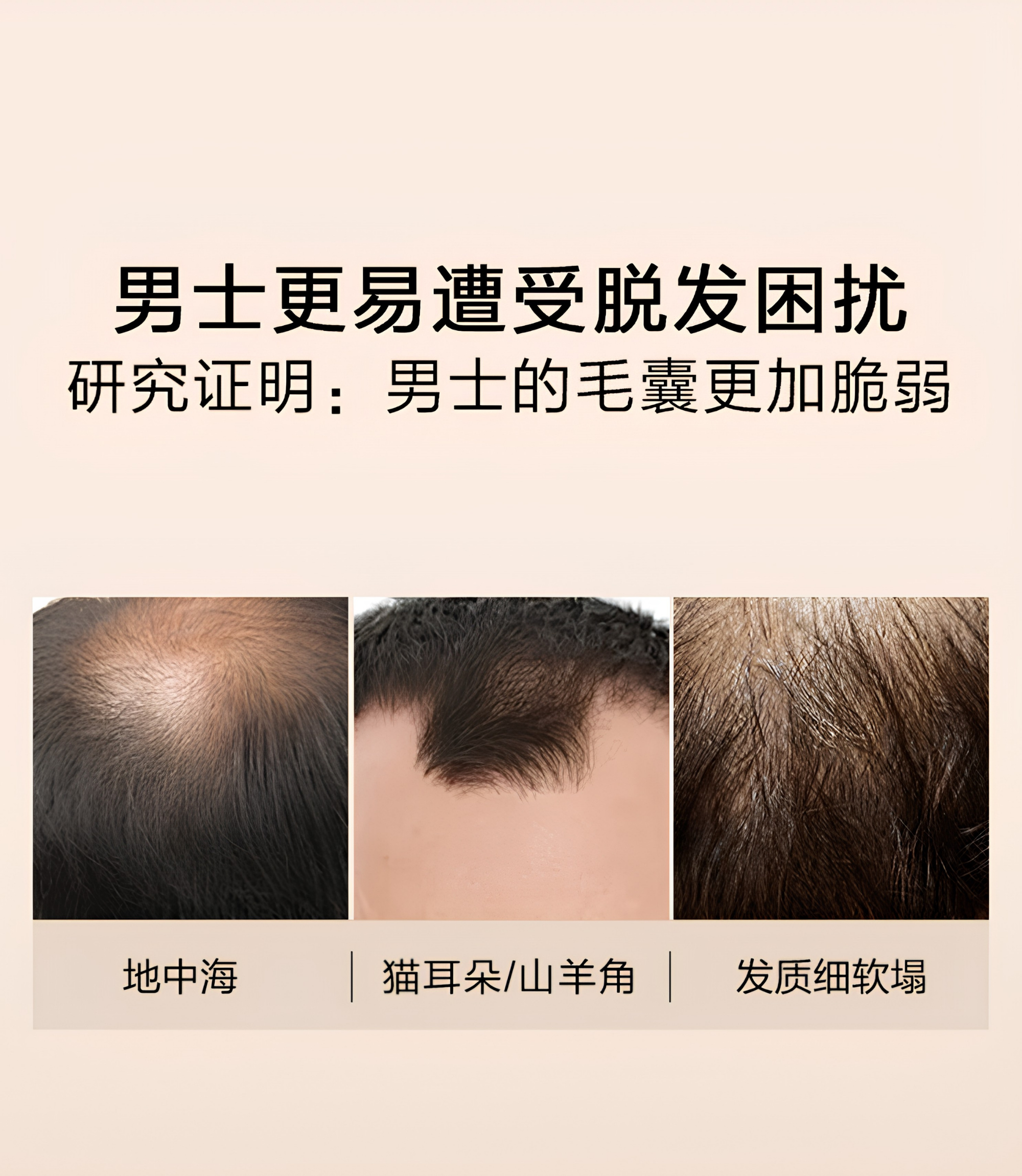 Kans Men's Anti-Hair Loss & Strengthening Shampoo 400g 韩束男士防脱固发修护洗发水