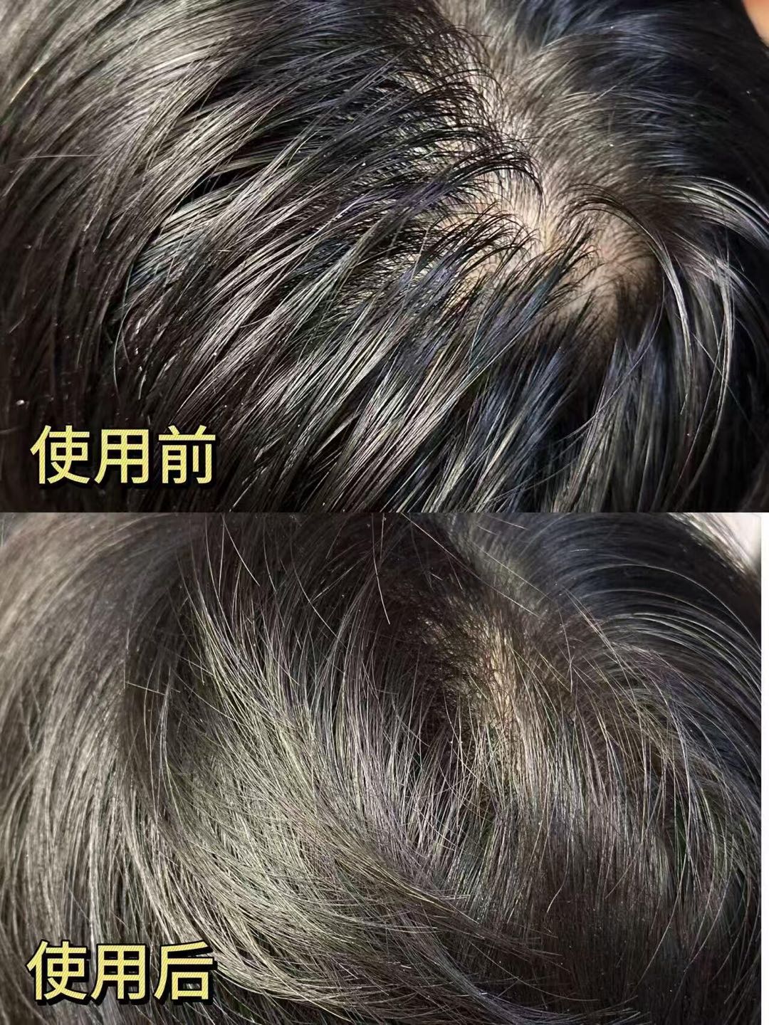 Kans Men's Anti-Hair Loss & Strengthening Shampoo 400g 韩束男士防脱固发修护洗发水