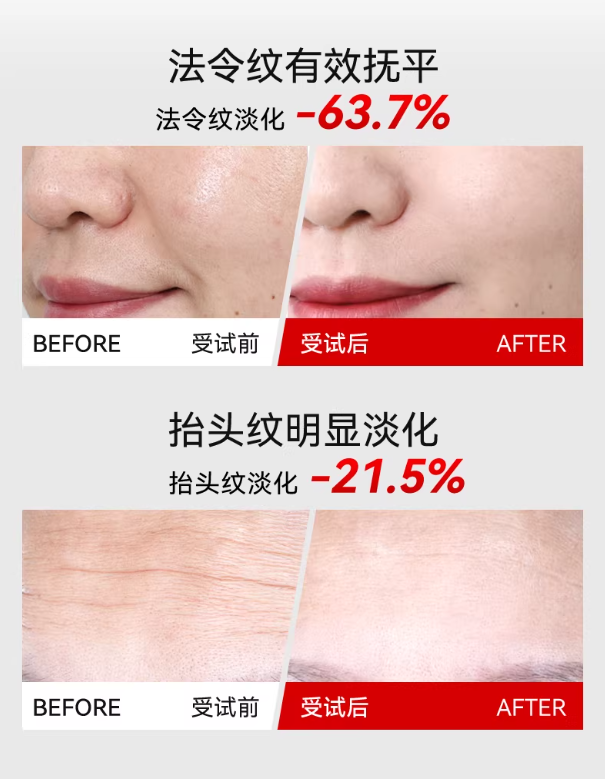 L'QUALYN 9-Color LED Beauty Wand 欧泉琳9彩LED美颜棒