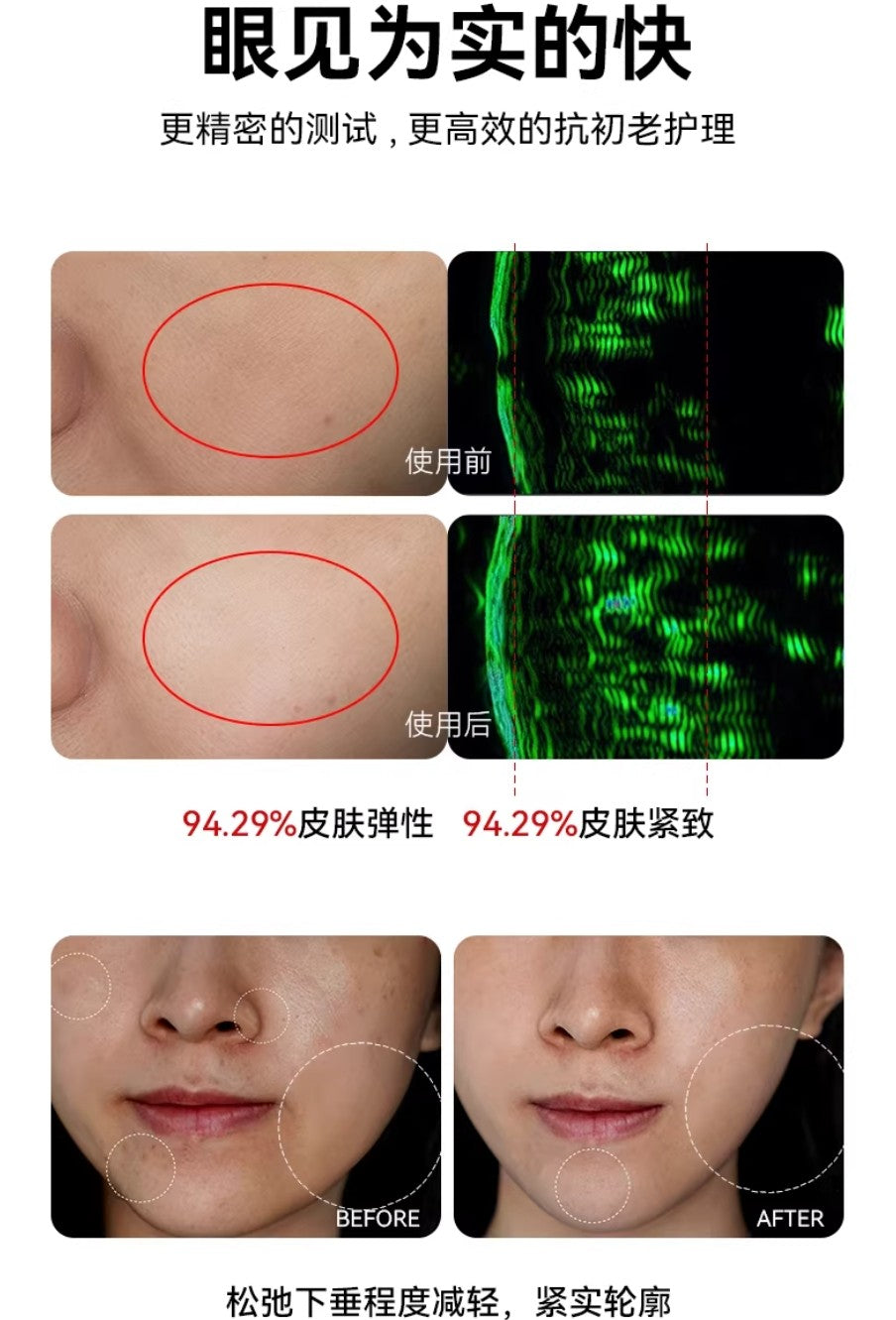 L'QUALYN Anti-Gravity Smart V-Face Device 欧泉琳反重力智能V脸仪