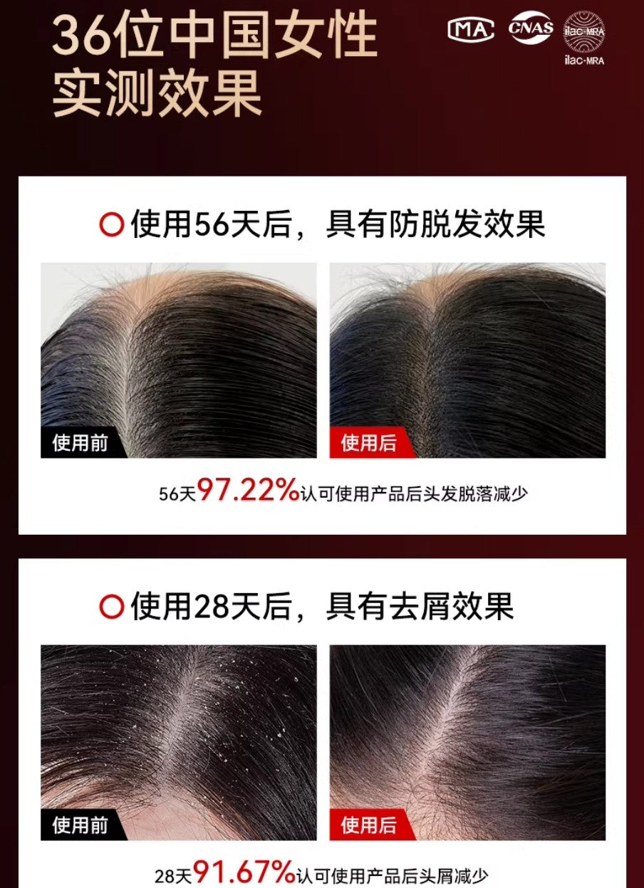 L'QUALYN Red Light Liquid Infusion Hair Growth Comb 欧泉琳红光导液健发梳