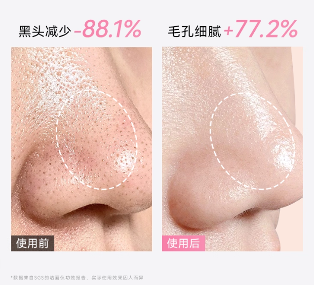 L'QUALYN Silicone Facial Cleansing Device 欧泉琳硅胶洁面仪