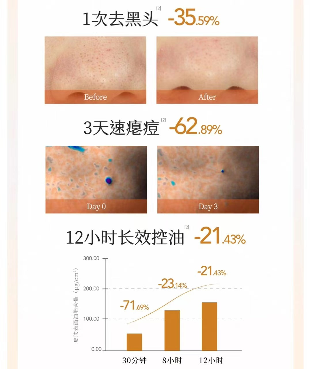 Little Dream Garden Calendula Oil Control Acne Cleanser 80g/120g 半亩花田金盏花控油祛痘洁面乳