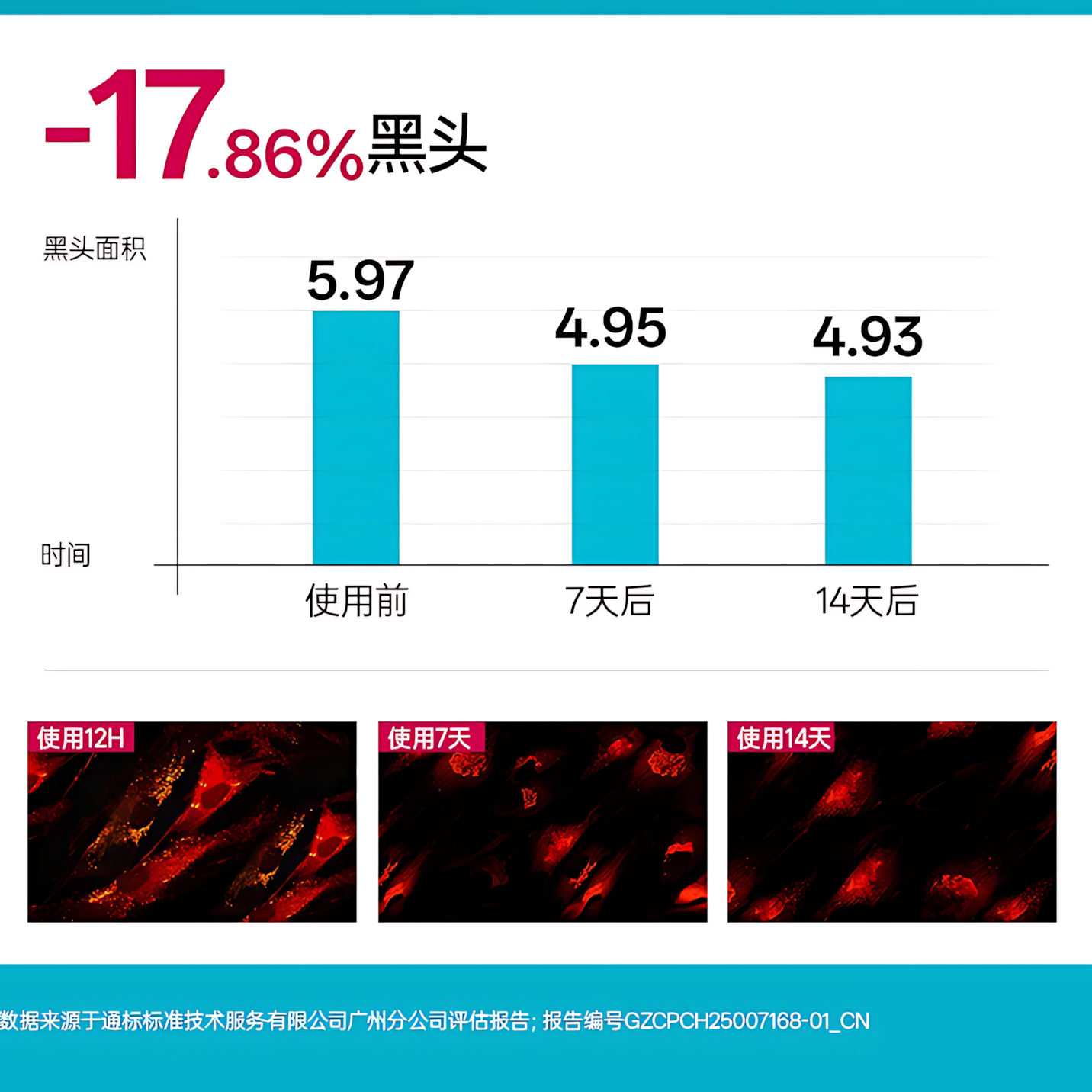 Tiktok/Douyin Hot MANCODES Mild Acid Anti-Acne Cleanser 150ml【Tiktok抖音爆款】左颜右色微酸祛痘洗面奶