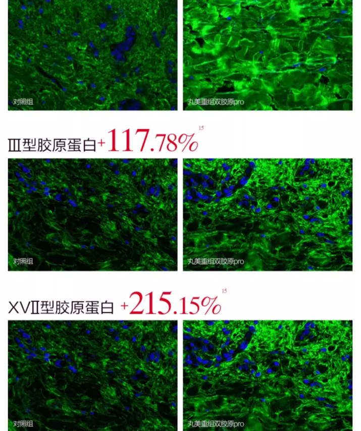 Marubi Recombinant Collagen Firming Lifting Facial Mask 20g*5pcs/box 丸美重组胶原蛋白紧致提拉面膜