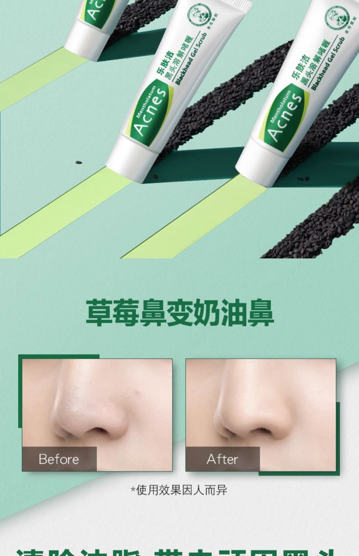 Dissolving Skin Mentholatum Skin Care Blackhead Dissolving Gel 18g 曼秀雷敦乐肤洁黑头溶解啫喱 | CuteHart