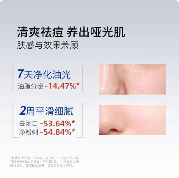 People Oil-Control Purifying Essence Lotion 15g/50g 皮宝控油清颜精华乳