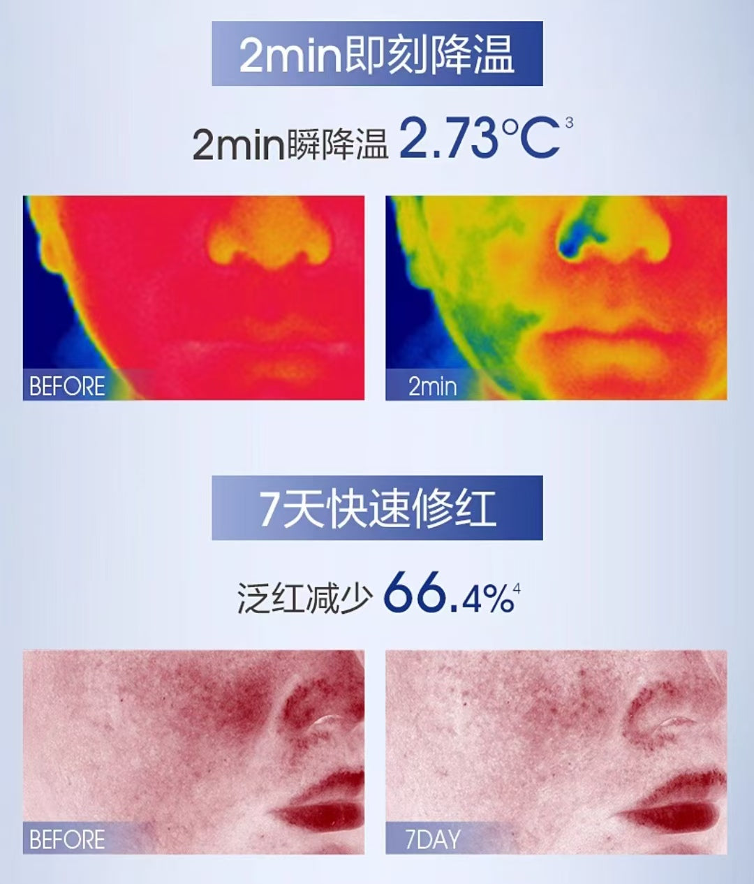 Proya Original Repair Relieving Lotion Set 120ml+120ml 珀莱雅源力水乳套装组合