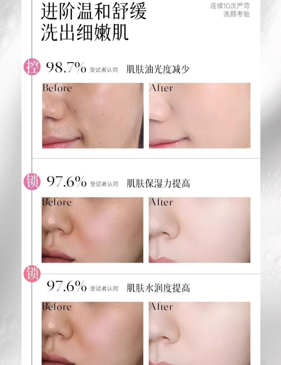 QINGYAN Sulfur Snake Gallbladder Oil-Controlfacial Cleanser 100g 倾颜硫磺蛇胆控油净颜洗面奶