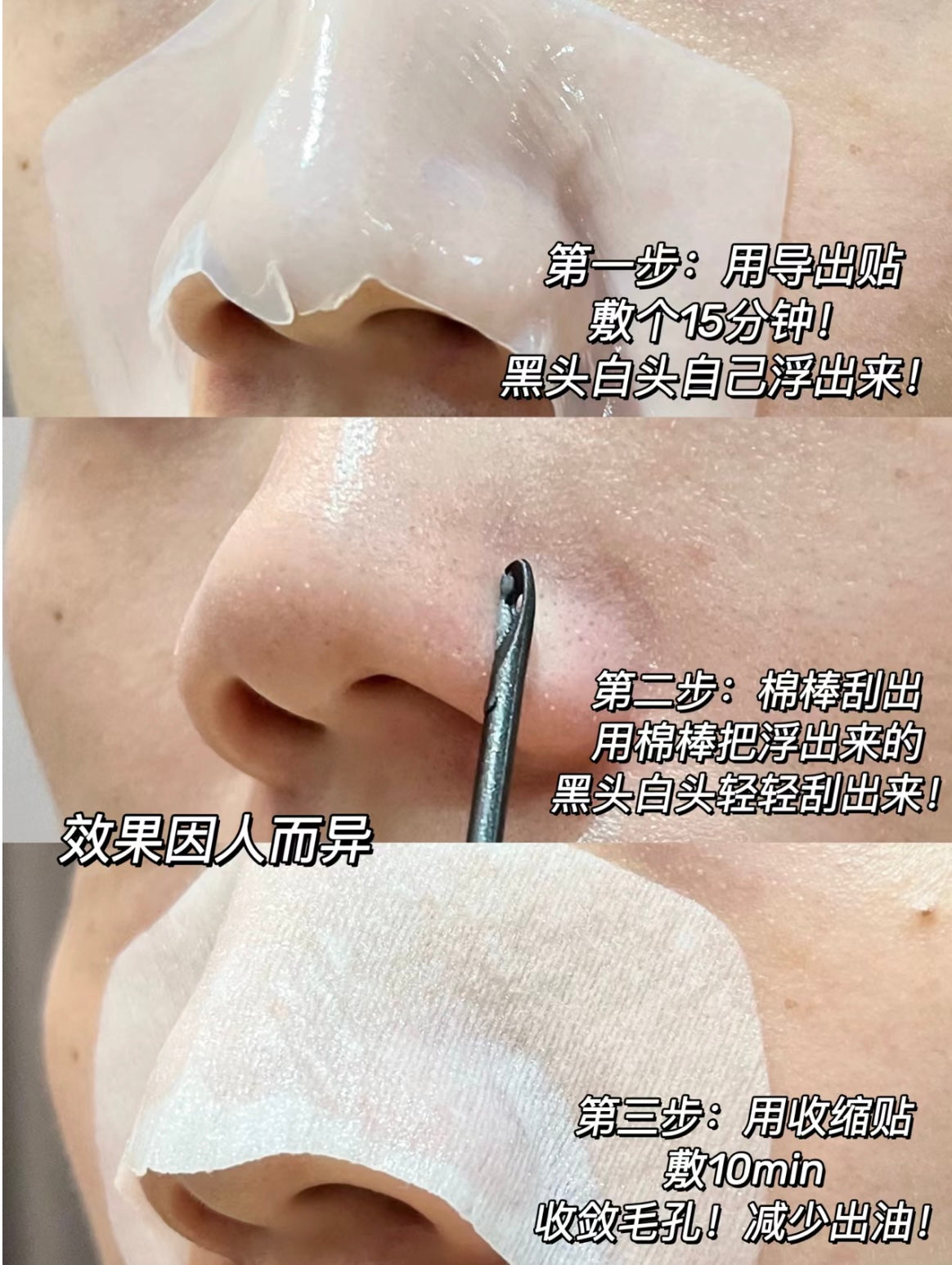 RNW Clear Nose Pack Blackhead Removal Pore Contraction 5sets/box 如薇去黑头清洁毛孔收缩鼻贴