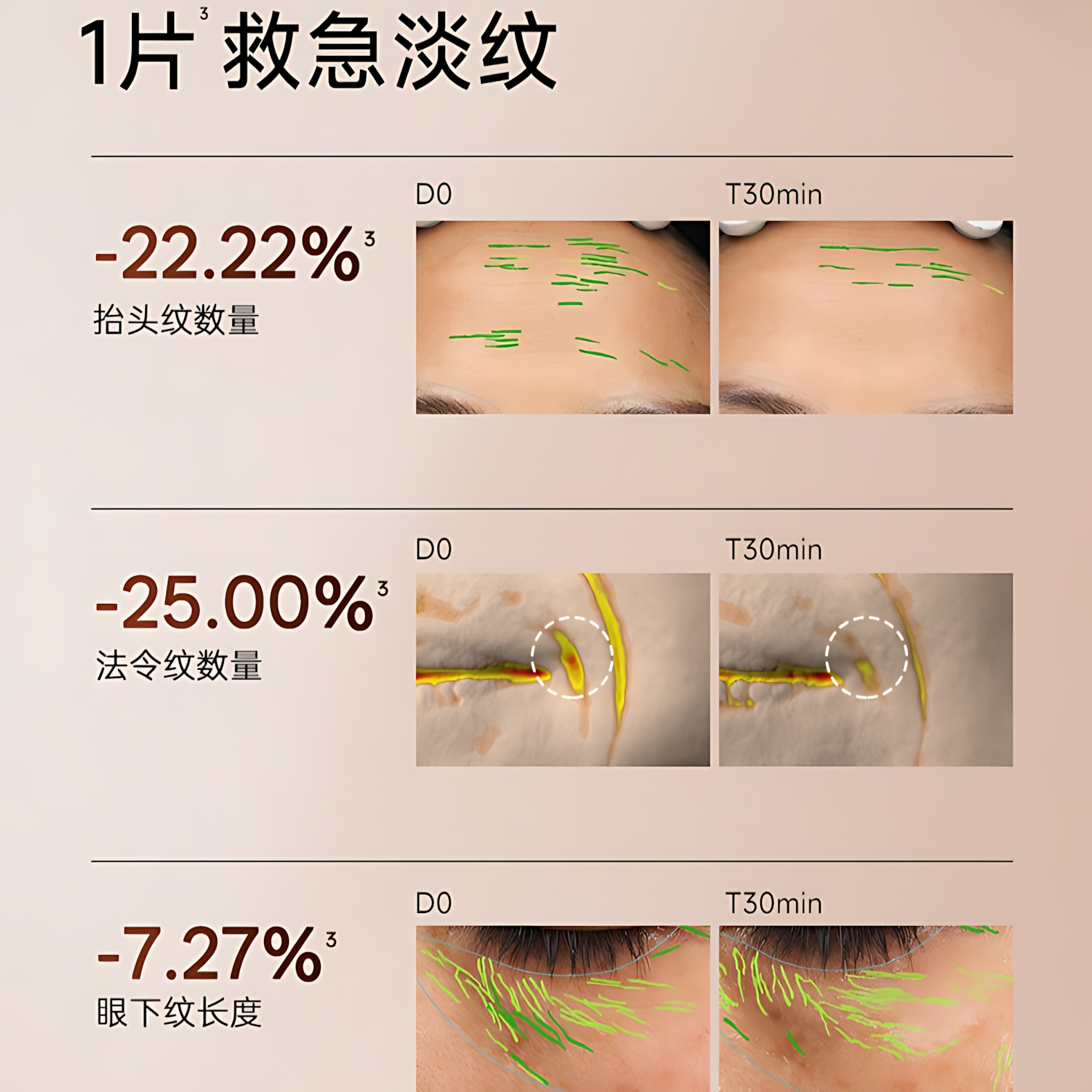 Skin Lane Sculptural Lifting Mask 36ml×5pcs/box 肌侣升塑智妍提拉面膜