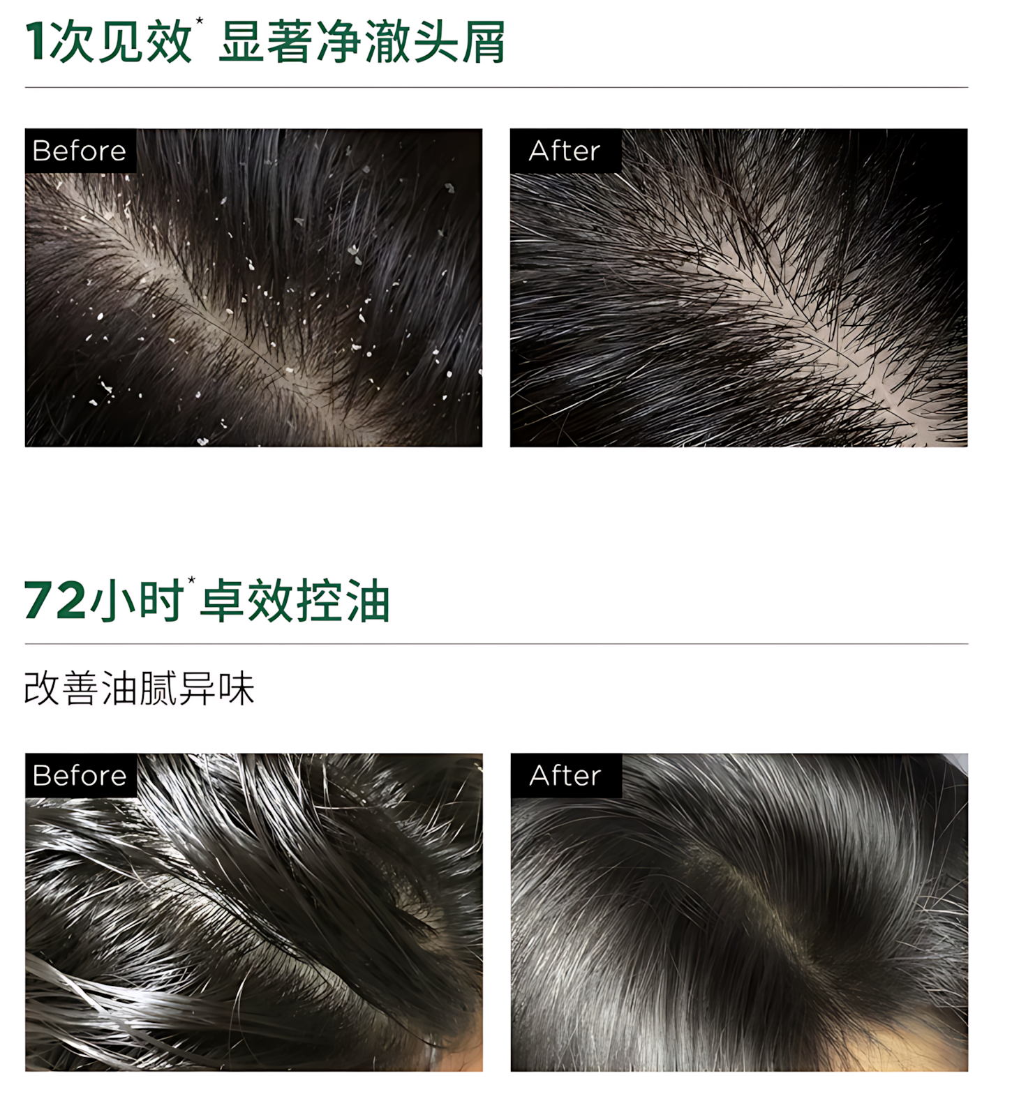 Tiktok/Douyin Hot 3odice Anti Hair Loss Dandruff Control Oil Control Shampoo 200ml/400ml【Tiktok抖音爆款】三蒂丝防脱去屑控油洗发水