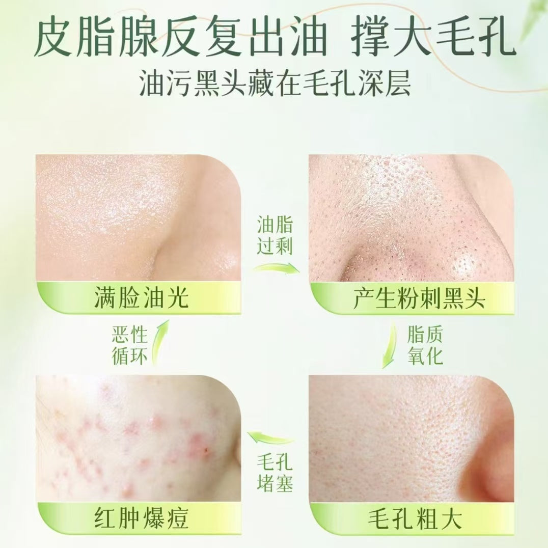 Tiktok/Douyin Hot BUV Chlorophyll Plant Extract Oil-Control Cleansing Mud 100g【Tiktok抖音爆款】BUV叶绿素植萃净透控油洁面泥