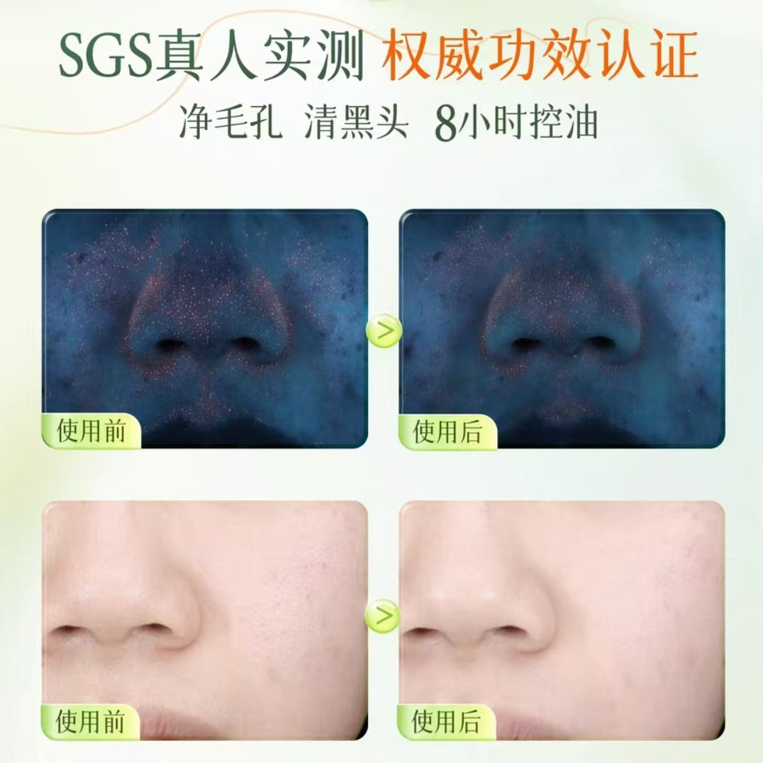 Tiktok/Douyin Hot BUV Chlorophyll Plant Extract Oil-Control Cleansing Mud 100g【Tiktok抖音爆款】BUV叶绿素植萃净透控油洁面泥