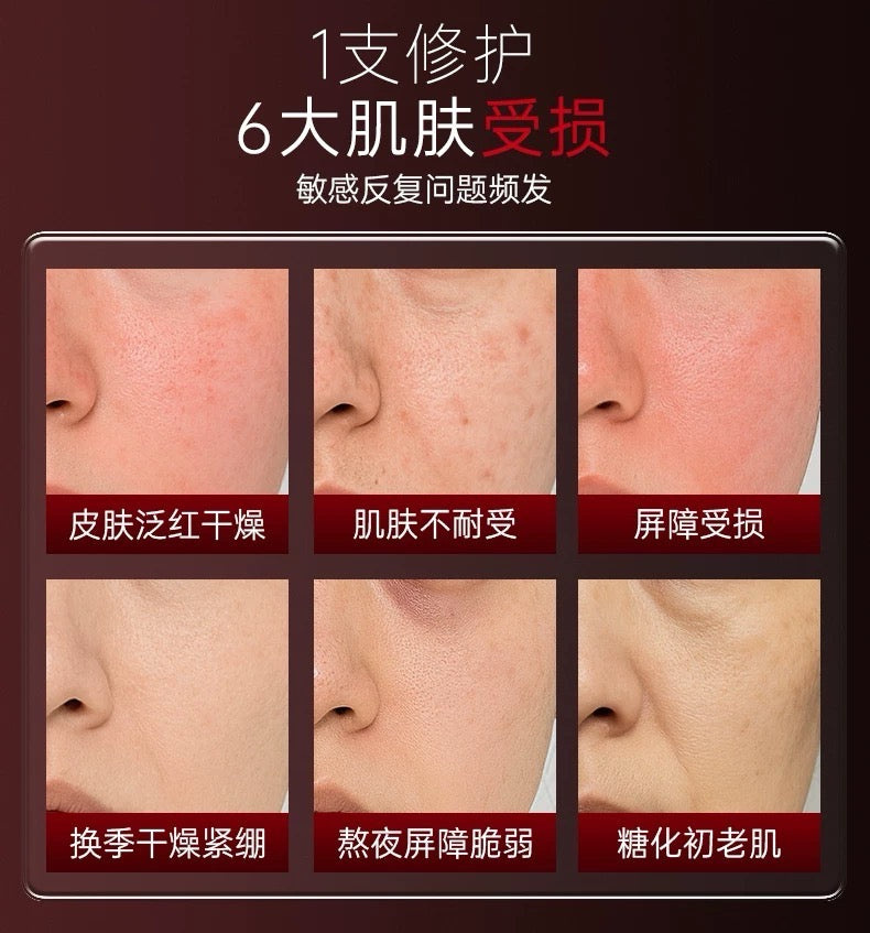 Tiktok/Douyin Hot HaSanlian PDRN Red Shield Dual-Anti Ampoule Serum 1.5ml*5pcs/30pcs【Tiktok抖音爆款】哈三联PDRN红盾双抗次抛精华液