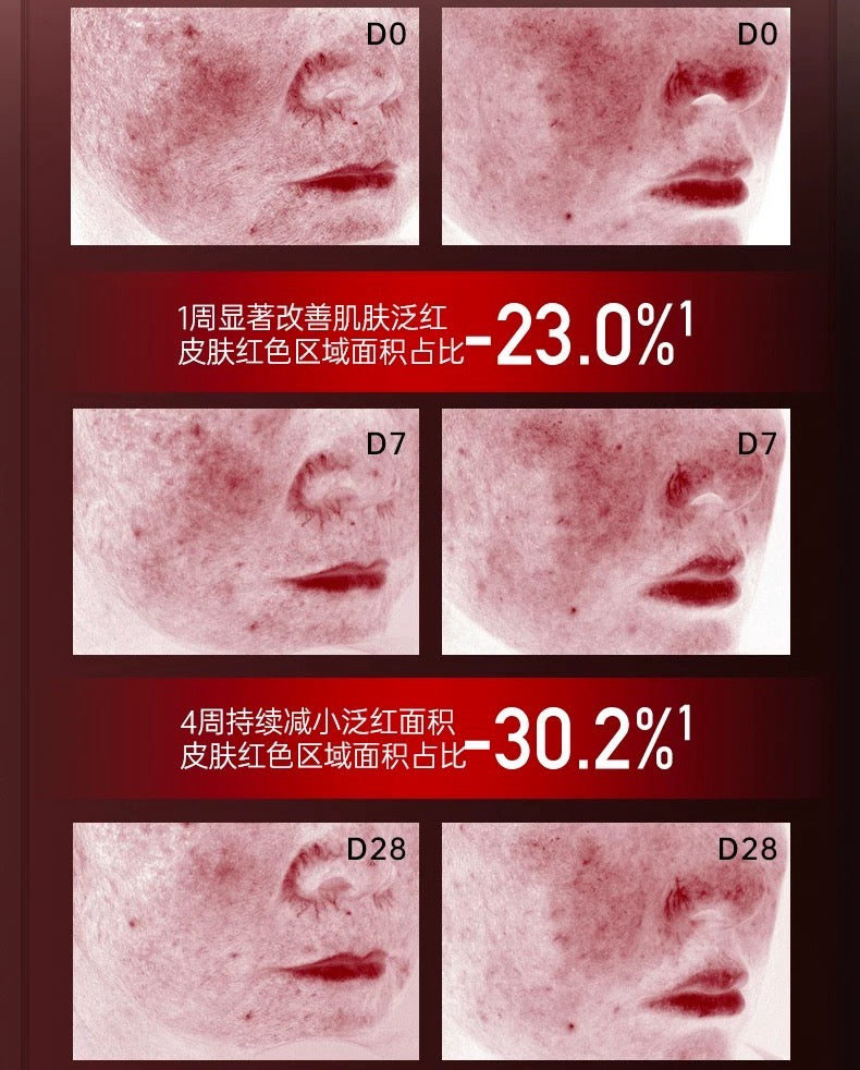 Tiktok/Douyin Hot HaSanlian PDRN Red Shield Dual-Anti Ampoule Serum 1.5ml*5pcs/30pcs【Tiktok抖音爆款】哈三联PDRN红盾双抗次抛精华液