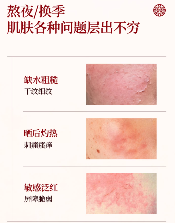 UNIFON Misty Rain Hyaluronic Acid Hydrating Black Facial Mask 御泥坊江南烟雨盈透清润黑面膜25ml*20pcs