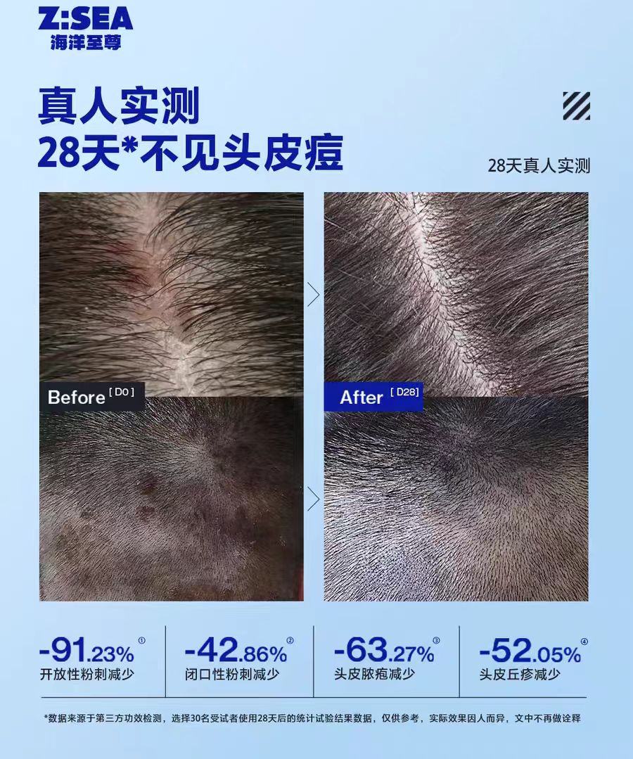 Z:SEA Water Oil-Control And Acne Cleansing Shampoo 400ml 海洋至尊水酷控油净痘洗发水