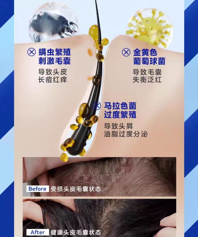 Z:SEA Water Oil-Control And Acne Cleansing Shampoo 400ml 海洋至尊水酷控油净痘洗发水